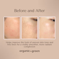 Kojic Turmeric Soap for Dark Spots - Infused with Hyaluronic Acid, Retinol, Vitamin E, Shea Butter, Collagen (3 Pack - Lemon, Fresh Ginger, and Lavender Scent)