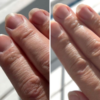 Chap Guard - Healing and Protects Moisturizer - GREAT BARRIER for skin + lip