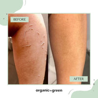 Premium Exfoliating Mitt for Body (2pc) – 100% Vegan Viscose Traditional Body Scrub Washcloth – Body Exfoliator